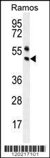 Anti-PAX5 Rabbit Polyclonal Antibody (PE (Phycoerythrin))