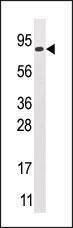 Anti-MOGS Rabbit Polyclonal Antibody (HRP (Horseradish Peroxidase))