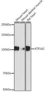 Western blot analysis of extracts of various cell lines, using Anti-ATP1A2 Antibody [ARC2458] (A307386) at 1:1,000 dilution