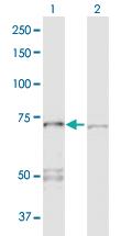 Anti-PPP2R1A Rabbit Polyclonal Antibody