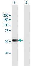 Anti-TSPYL6 Mouse Polyclonal Antibody