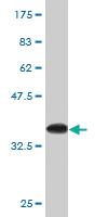 Anti-AURKB Mouse Monoclonal Antibody [clone: 5H7]