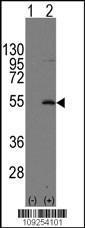 Anti-ERVW-1 Rabbit Polyclonal Antibody (AP (Alkaline Phosphatase))