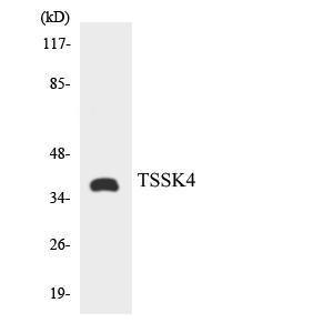 Western blot analysis of the lysates from HT 29 cells using Anti-TSSK4 Antibody