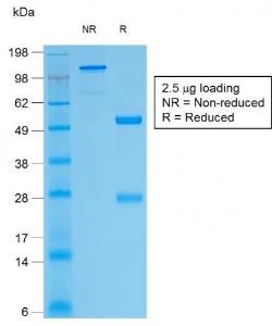 SDS-PAGE analysis of Anti-Thyroglobulin Antibody [TGB/1968R] under non-reduced and reduced conditions; showing intact IgG and intact heavy and light chains, respectively. SDS-PAGE analysis confirms the integrity and purity of the antibody.