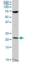 Anti-LCN1 Mouse Polyclonal Antibody