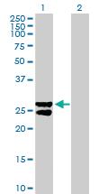 Anti-MMAB Mouse Polyclonal Antibody