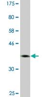 Anti-NFIC Mouse Monoclonal Antibody [clone: 2B6]