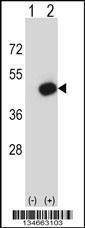 Anti-PDK2 Rabbit Polyclonal Antibody (Biotin)