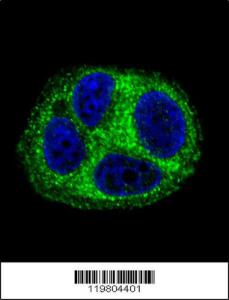 Anti-QTRTD1 Rabbit Polyclonal Antibody (HRP (Horseradish Peroxidase))