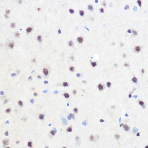 Anti-ZNF207/BUGZ Rabbit Polyclonal Antibody