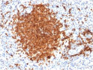 Anti-CD22 Mouse Monoclonal Antibody [clone: BLCAM/1795]