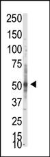 Anti-PRMT3 Rabbit Polyclonal Antibody