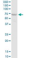 Anti-PPP2R1A Mouse Monoclonal Antibody [clone: 4E6]