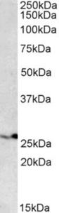 EB10296 (0.1 µg/ml) staining of HEK293 lysate (35 µg protein in RIPA buffer). Primary incubation was 1 hour. Detected by chemiluminescence.