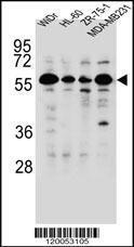 Anti-FOXC2 Rabbit Polyclonal Antibody