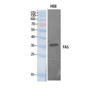 Western blot analysis of extracts from HEB cells using Anti-FAS Antibody