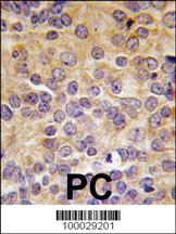 Anti-PRMT3 Rabbit Polyclonal Antibody