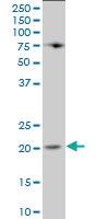 Anti-LCN1 Mouse Polyclonal Antibody