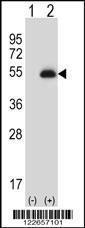 Anti-PAX6 Rabbit Polyclonal Antibody (AP (Alkaline Phosphatase))