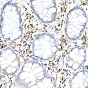 Immunohistochemistry analysis of paraffin-embedded human colon tissue using Anti-cGAS Antibody (A16161) at a dilution of 1:50 (40x lens). Perform high pressure antigen retrieval with 10 mM citrate buffer pH 6.0 before commencing with IHC staining protocol.