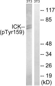 Western blot analysis of lysates from NIH/3T3 cells treated with starved 24h using Anti-ICK (phospho Tyr159) Antibody The right hand lane represents a negative control, where the antibody is blocked by the immunising peptide