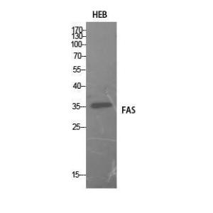 Western blot analysis of HEB cells using Anti-FAS Antibody