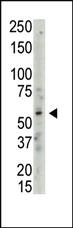 Anti-PRMT3 Rabbit Polyclonal Antibody