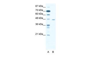 Anti-CTBP1 Rabbit Polyclonal Antibody