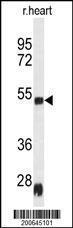 Anti-SERPINH1 Mouse Monoclonal Antibody (AP (Alkaline Phosphatase)) [clone: 134CT3.1.1]