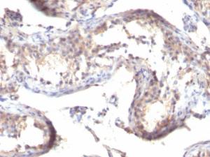 Immunohistochemical analysis of formalin-fixed, paraffin-embedded human testicular carcinoma using Anti-TGF alpha Antibody [MF9]