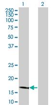 Anti-LCN1 Mouse Monoclonal Antibody [clone: 1B11]