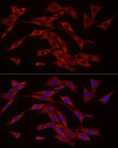 Immunofluorescence analysis of NIH/3T3 cells using Anti-cGAS Antibody (A16161) at a dilution of 1:50 (40x lens). DAPI was used to stain the cell nuclei (blue).