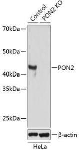 Western blot analysis of extracts from normal (control) and PON2 knockout (KO) HeLa cells, using Anti-PON2 Antibody (A307389) at 1:1000 dilution