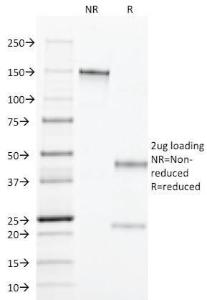 SDS-PAGE analysis of Anti-TGF alpha Antibody [MF9] under non-reduced and reduced conditions; showing intact IgG and intact heavy and light chains, respectively. SDS-PAGE analysis confirms the integrity and purity of the antibody