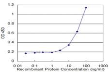 Anti-LCN1 Mouse Monoclonal Antibody [clone: 1B11]