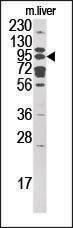 Anti-MOGS Rabbit Polyclonal Antibody (AP (Alkaline Phosphatase))