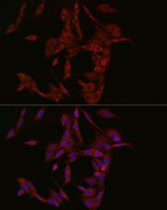 Immunofluorescence analysis of PC-12 cells using Anti-cGAS Antibody (A16161) at a dilution of 1:50 (40x lens). DAPI was used to stain the cell nuclei (blue).