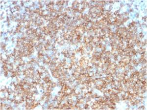 Anti-CD22 Mouse Monoclonal Antibody [clone: BLCAM/1795]