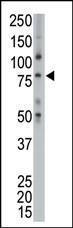 Anti-TPX2 Rabbit Polyclonal Antibody (AP (Alkaline Phosphatase))