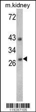 Anti-ENDOG Rabbit polyclonal antibody