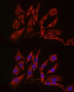 Immunofluorescence analysis of U2OS cells using Anti-cGAS Antibody (A16161) at a dilution of 1:50 (40x lens). DAPI was used to stain the cell nuclei (blue).