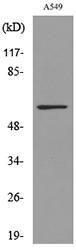 Western blot analysis of lysate from A549 cells using Anti-ALDH2 Antibody