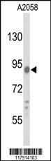 Anti-LY6E Rabbit Polyclonal Antibody