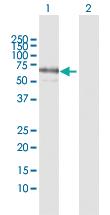 Anti-PPM1J Rabbit Polyclonal Antibody