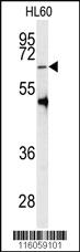 Anti-PRMT5 Rabbit Polyclonal Antibody