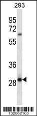 Anti-MRAP2 Rabbit Polyclonal Antibody