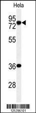 Anti-INTS10 Rabbit Polyclonal Antibody