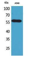 Western blot analysis of A549 cells using Anti-ALDH2 Antibody