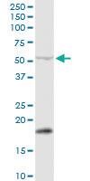 Anti-PPM1J Rabbit Polyclonal Antibody